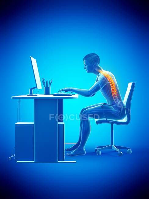 Біль у спині офісного працівника сидить і працює за столом, концептуальна ілюстрація . — стокове фото