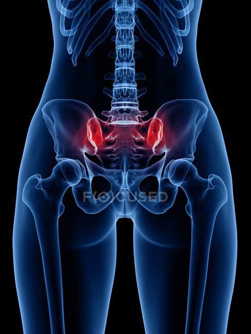 Menschliche Silhouette mit Schmerzen im unteren Rückenbereich, konzeptionelle Illustration. — Stockfoto