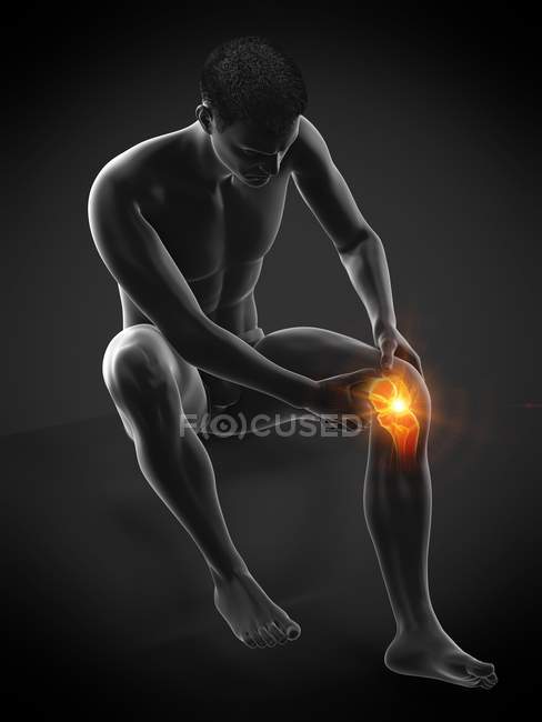 Силуэт сидящего человека с болью в колене, концептуальная иллюстрация . — стоковое фото
