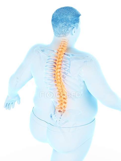 Fettleibige männliche Körper in Hochformat mit Rückenschmerzen, digitale Illustration. — Stockfoto
