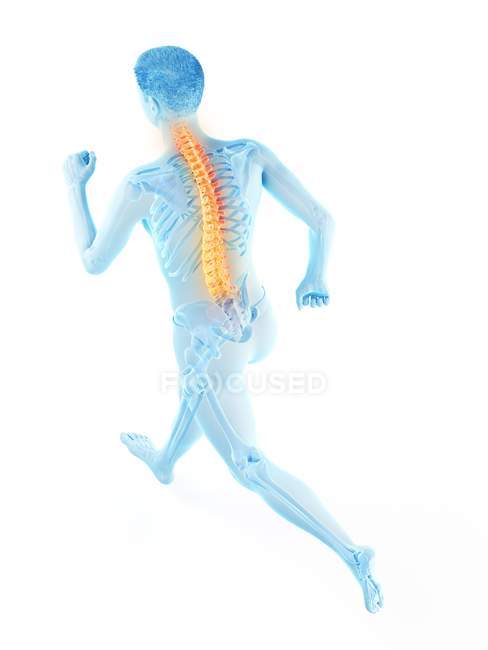 Силуэт бегущего спортсмена с болью в спине, концептуальная иллюстрация . — стоковое фото