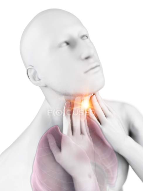 Cuerpo masculino abstracto con dolor de garganta sobre fondo blanco, ilustración digital conceptual
. - foto de stock
