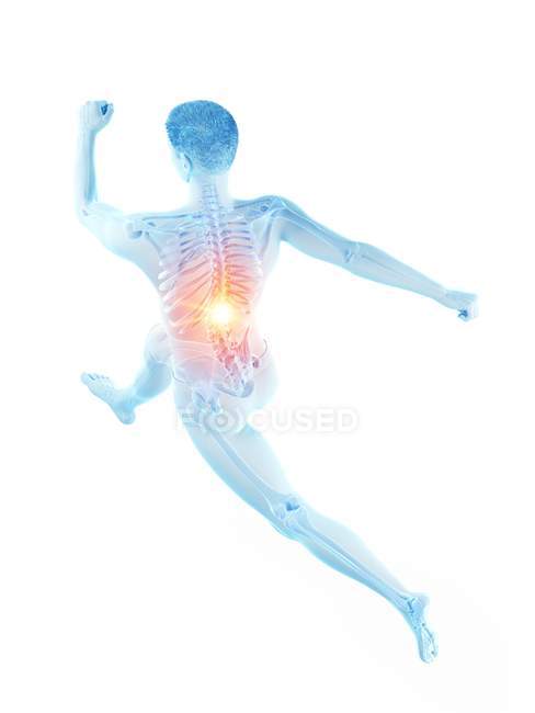 Silueta de corredor masculino con dolor de espalda en vista de ángulo alto, ilustración conceptual . - foto de stock
