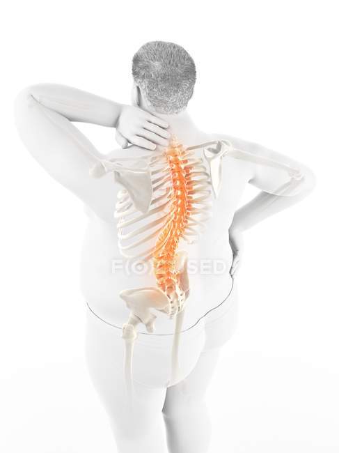 Чоловіче тіло з болем у спині під високим кутом зору, цифрова ілюстрація . — стокове фото