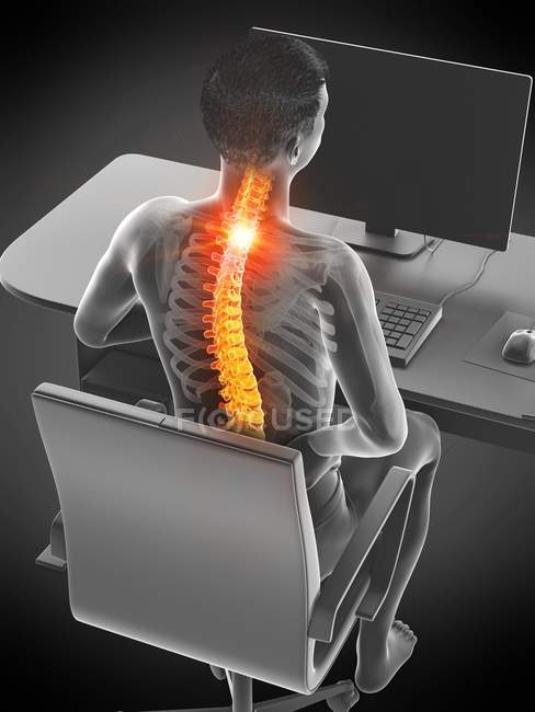 Trabajador de oficina con dolor de espalda en vista de ángulo alto, ilustración conceptual . - foto de stock