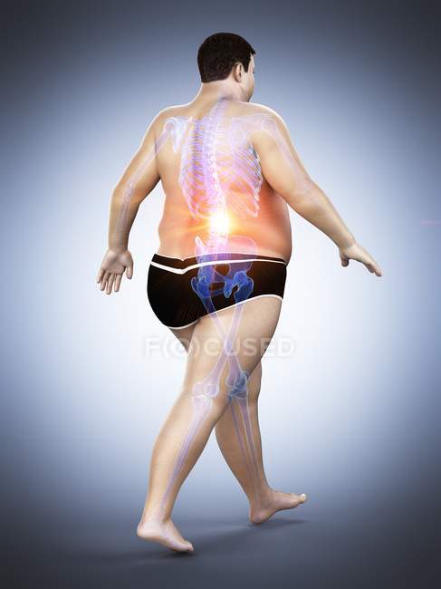 Walking obese male silhouette with visible back pain, digital illustration. — Stock Photo