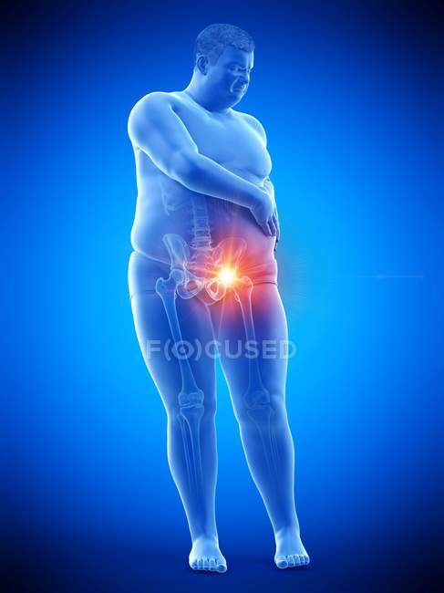 Silueta de hombre obeso con dolor de cadera, ilustración digital . - foto de stock