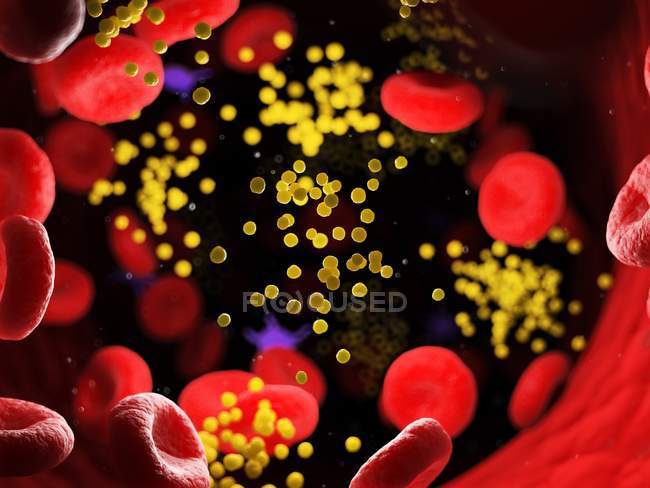 Grasa en las células sanguíneas que bloquean los vasos sanguíneos, ilustración digital
. - foto de stock