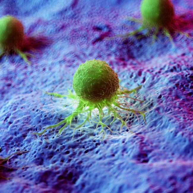 Abstrato células de câncer de cor verde no tecido, ilustração digital
. — Fotografia de Stock