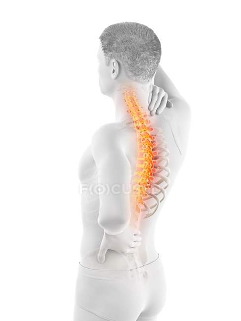 Чоловічий силует з болем у спині, концептуальна ілюстрація . — стокове фото