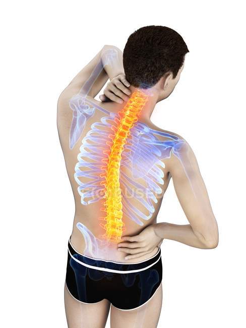 Männliche Silhouette mit Rückenschmerzen auf weißem Hintergrund, konzeptionelle Illustration. — Stockfoto