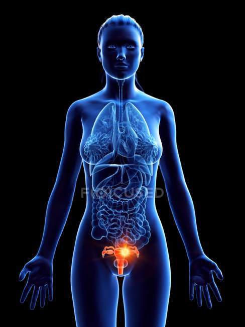 Abstrakter weiblicher Körper mit Gebärmutterkrebs, digitale Illustration. — Stockfoto