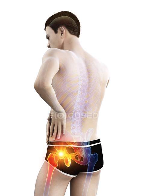 Silhouette masculine abstraite avec douleur visible à la hanche, illustration numérique . — Photo de stock
