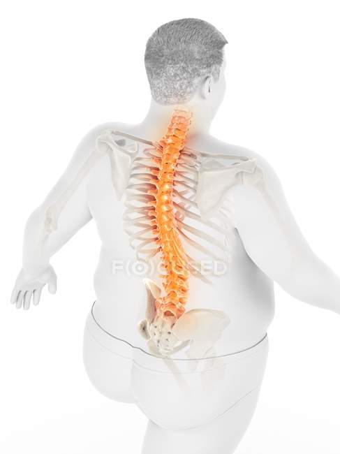 Ожирение мужского тела с болью в спине под высоким углом зрения, цифровая иллюстрация . — стоковое фото
