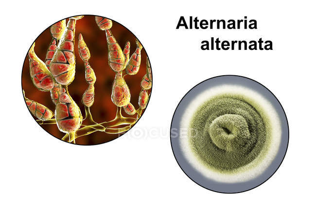 Цифровая иллюстрация грибковой морфологии нитевидного аллергенного гриба Alternaria alternata и фотография грибковых колоний на Sabouraud Dextrose Agar . — стоковое фото
