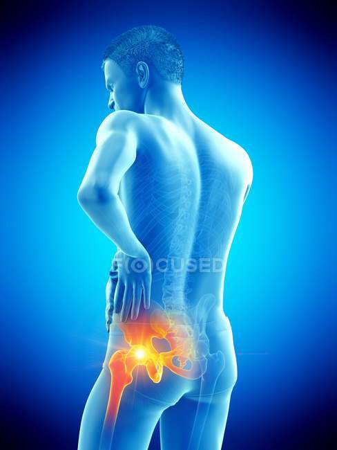 Silueta masculina abstracta con dolor de cadera visible, ilustración digital . - foto de stock