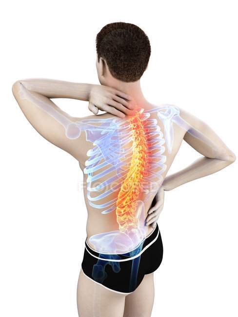 Silhueta masculina com dor nas costas em visão de alto ângulo, ilustração conceitual . — Fotografia de Stock