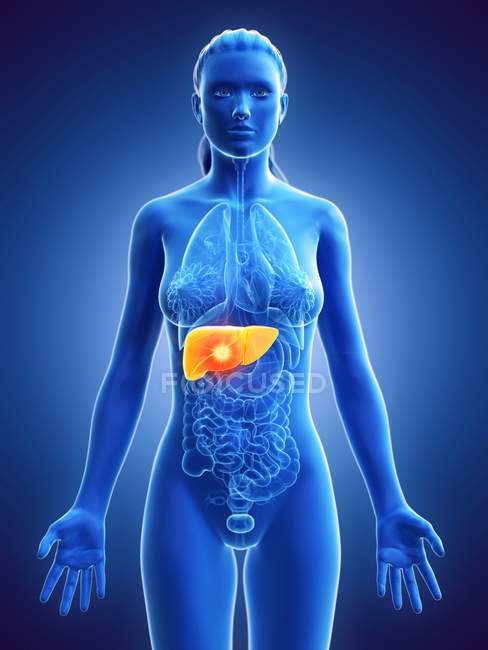 Silhouette femminile con tumore al fegato su sfondo blu, illustrazione al computer . — Foto stock