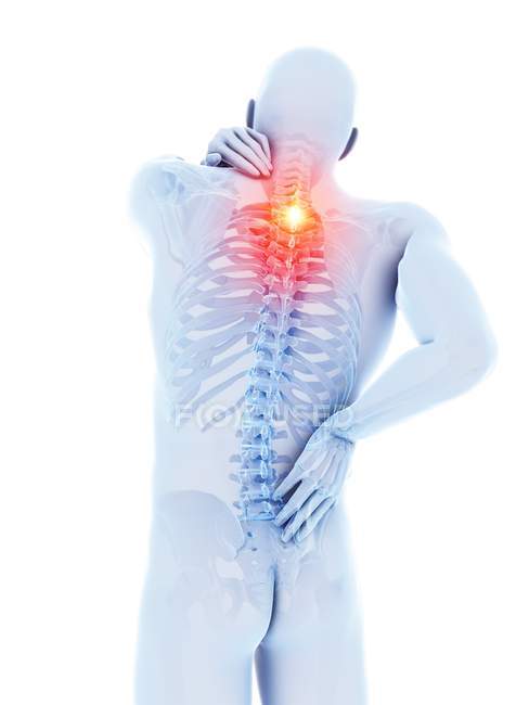 Corpo masculino com dor nas costas em fundo branco, ilustração digital . — Fotografia de Stock