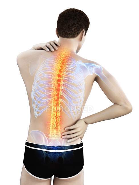 Мужской силуэт с болью в спине, концептуальная иллюстрация . — стоковое фото