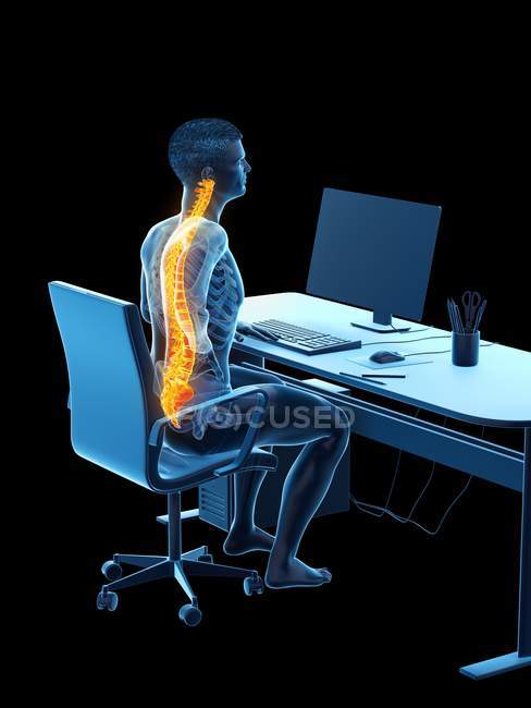 Ufficio silhouette lavoratore seduto alla scrivania con mal di schiena, illustrazione concettuale
. — Foto stock
