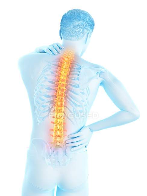 Männliche Silhouette mit Rückenschmerzen, konzeptionelle Illustration. — Stockfoto