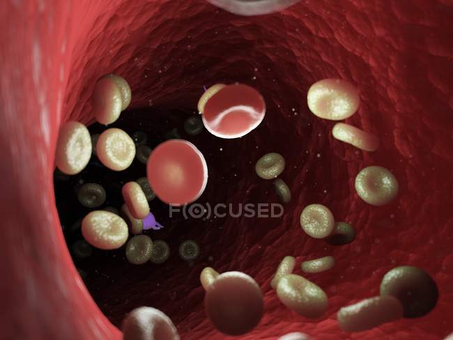 Células sanguíneas enfermas con bacterias, ilustración por computadora
. - foto de stock