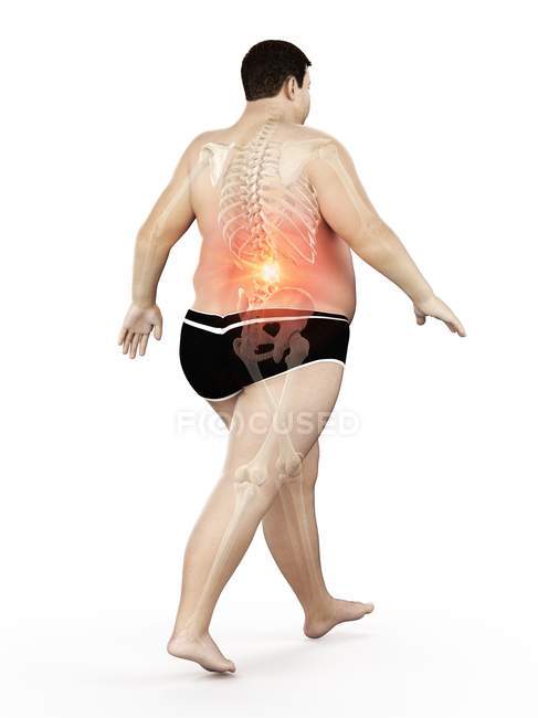 Forma maschile obesa a piedi con dolore alla schiena visibile, illustrazione digitale . — Foto stock