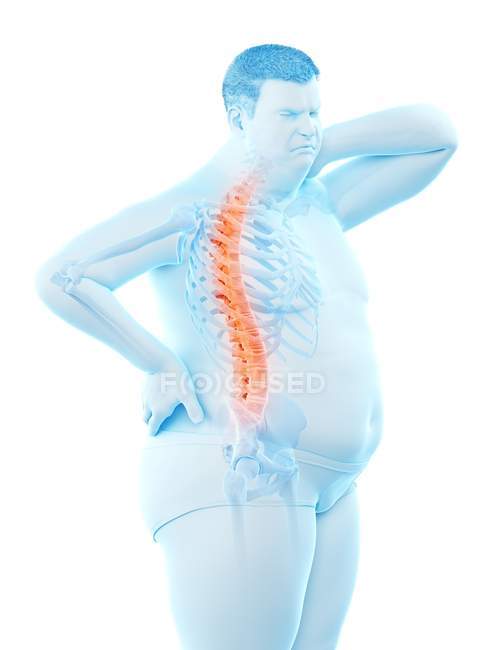 Corpo maschile obeso con mal di schiena, illustrazione digitale . — Foto stock