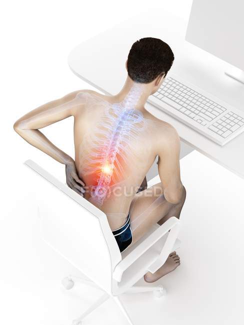 Trabajador de oficina con dolor de espalda debido a sentarse en vista de ángulo alto, ilustración digital
. - foto de stock