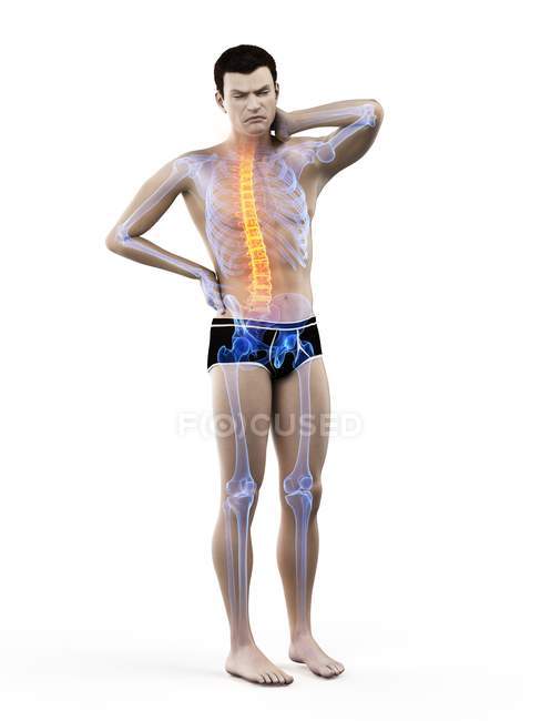 Vue de face du corps masculin avec maux de dos, illustration conceptuelle . — Photo de stock
