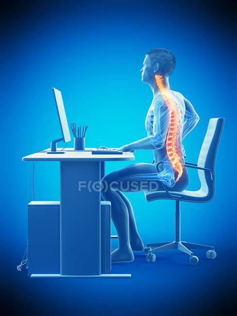 Trabalhador de escritório masculino com dor nas costas, ilustração conceitual . — Fotografia de Stock