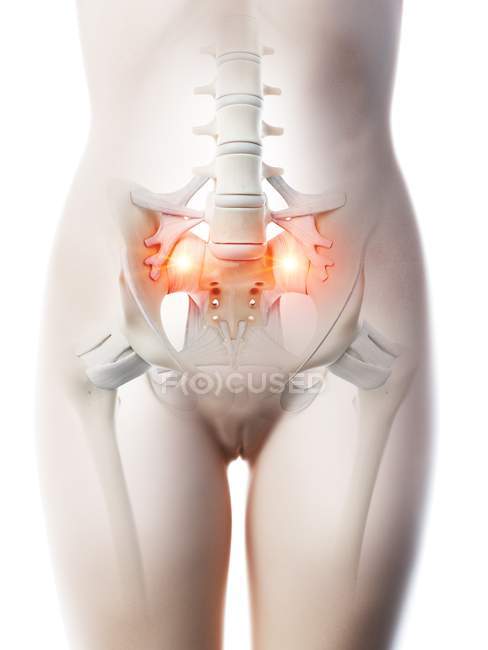 Abstrakte weibliche Hüften, die Schmerzen im unteren Rückenbereich zeigen, konzeptionelle Illustration. — Stockfoto