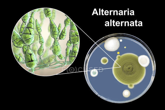Illustrazione digitale della morfologia fungina del fungo allergenico filamentoso Alternaria alternata e fotografia di colonie fungine su Sabouraud Destrosio Agar . — Foto stock