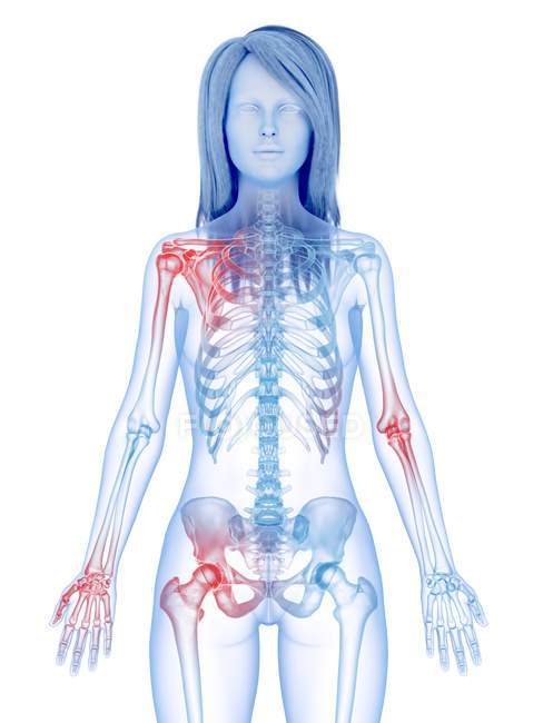 Articulations douloureuses dans le corps féminin, illustration conceptuelle
. — Photo de stock