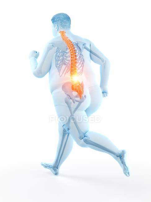 Obese male runner body with back pain, conceptual illustration. — Stock Photo