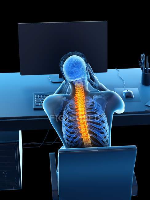 Travailleur de bureau stressé avec maux de dos dans la vue arrière, illustration conceptuelle . — Photo de stock
