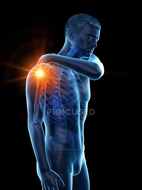 Silhueta do homem com dor no ombro, ilustração conceitual . — Fotografia de Stock
