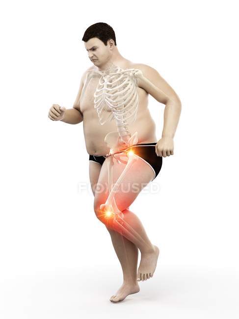 Силуэт бега толстяка с болью в суставах, компьютерная иллюстрация . — стоковое фото