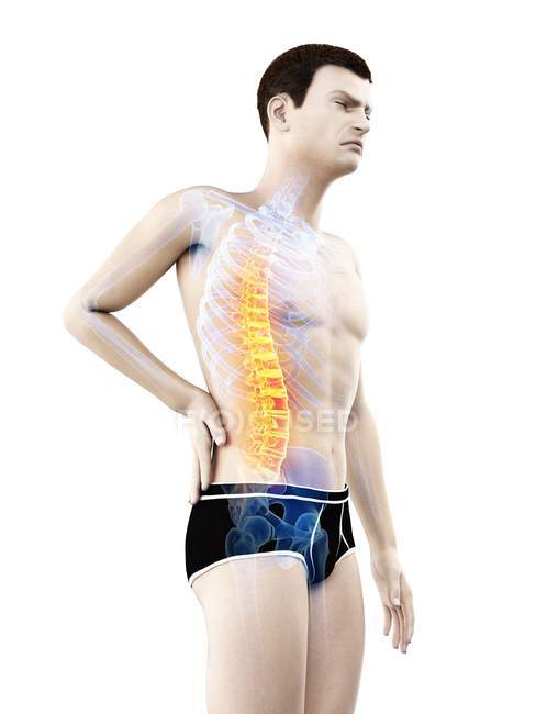 Vue latérale du corps masculin avec maux de dos sur fond blanc, illustration conceptuelle . — Photo de stock