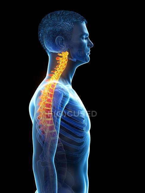Male silhouette with neck pain, conceptual illustration. — Stock Photo