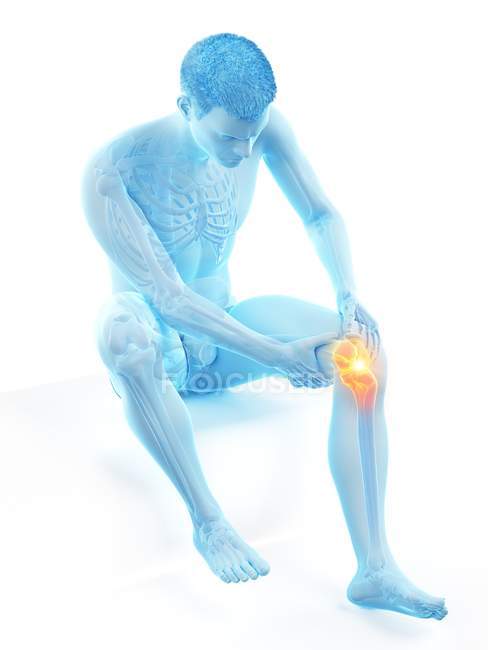 Silhouette dell'uomo seduto con dolore al ginocchio, illustrazione concettuale . — Foto stock