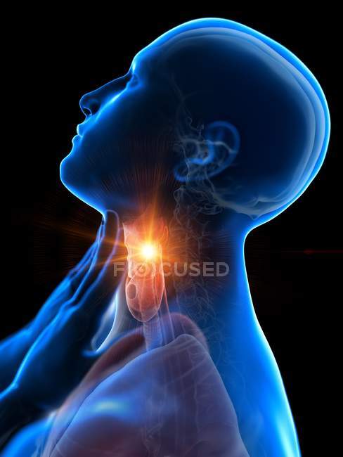 Cuerpo masculino abstracto con dolor de garganta sobre fondo negro, ilustración digital conceptual . - foto de stock