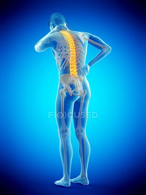 Rückansicht des männlichen Körpers in voller Länge mit Rückenschmerzen, konzeptionelle Illustration. — Stockfoto