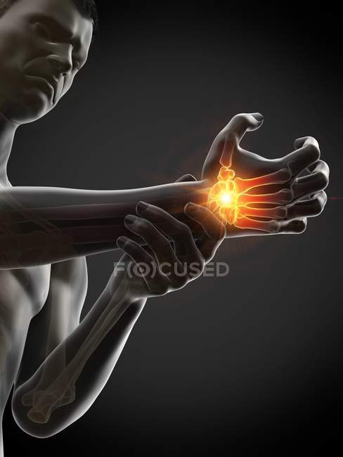 Corpo masculino com dor de pulso brilhante, ilustração conceitual . — Fotografia de Stock