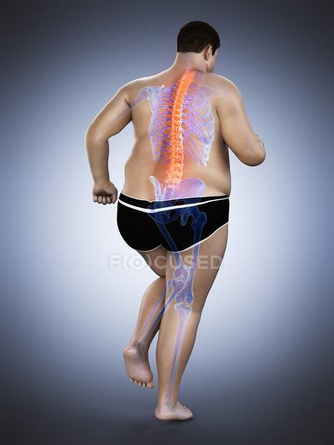Übergewichtiger männlicher Läuferkörper mit Rückenschmerzen, konzeptionelle Illustration. — Stockfoto