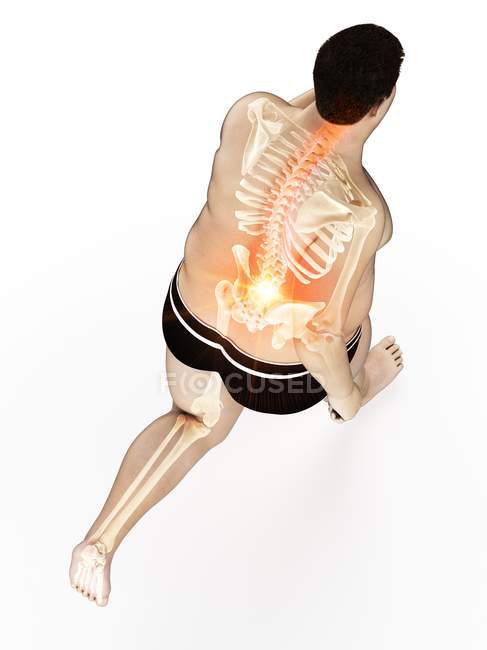 Високий кут зору на бігуна з надмірною вагою з болем у спині, цифрова ілюстрація . — стокове фото