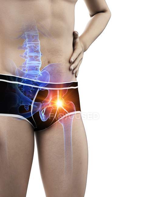 Silueta corporal masculina con dolor de cadera visible, ilustración digital
. - foto de stock
