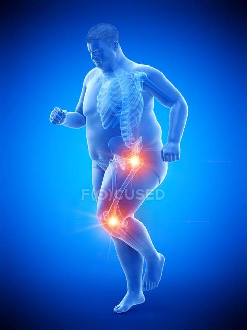 Silhueta de homem obeso correndo com dor nas articulações, ilustração do computador . — Fotografia de Stock