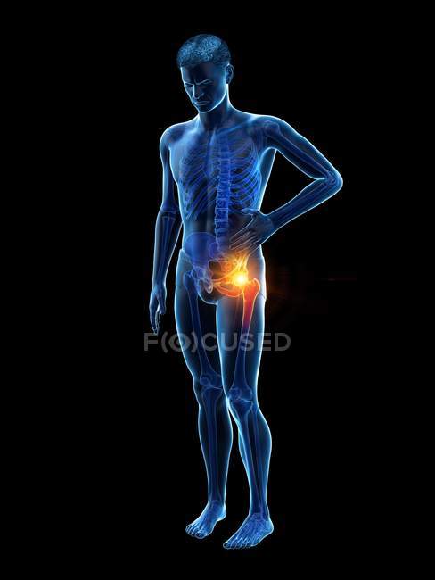 Silhueta do homem com dor no quadril, ilustração digital . — Fotografia de Stock